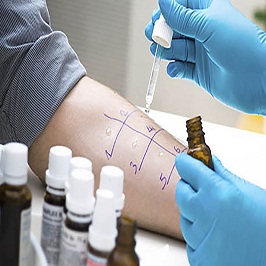 Allergy Testing on patient