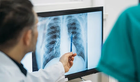 Doctor viewing chest X-ray
